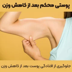 جلوگیری از افتادگی پوست بعد از کاهش وزن با چند راهکار ساده