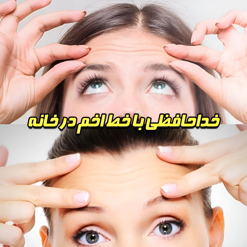 خداحافظی با خط اخم پیشانی در خانه؛ روش‌های ساده و مقرون‌به‌صرفه